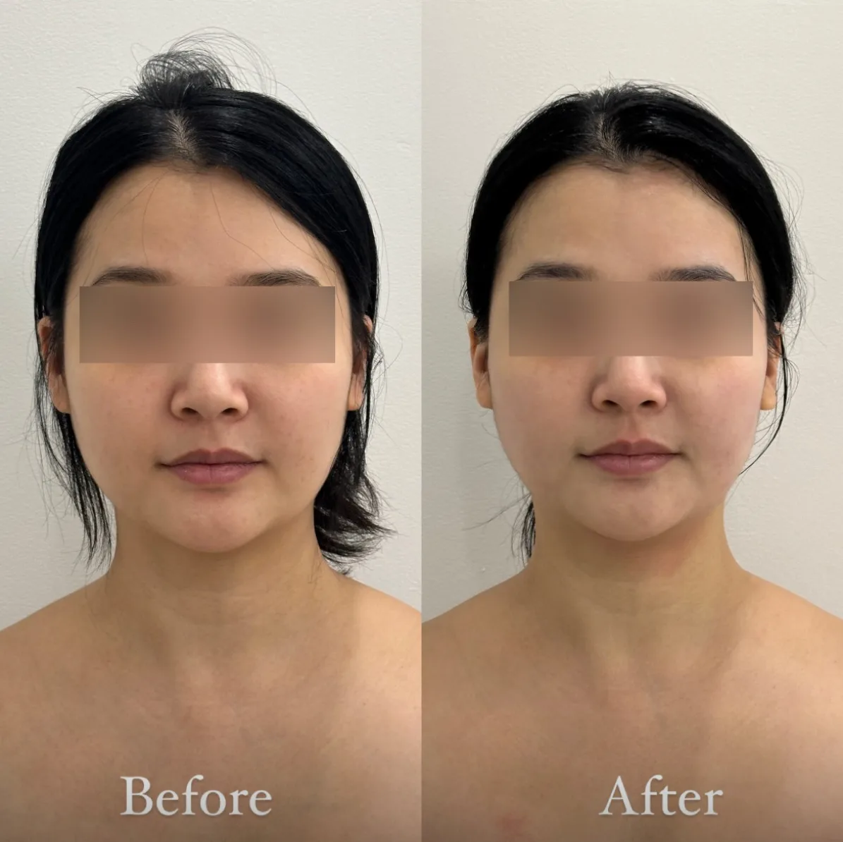 3D 작은얼굴